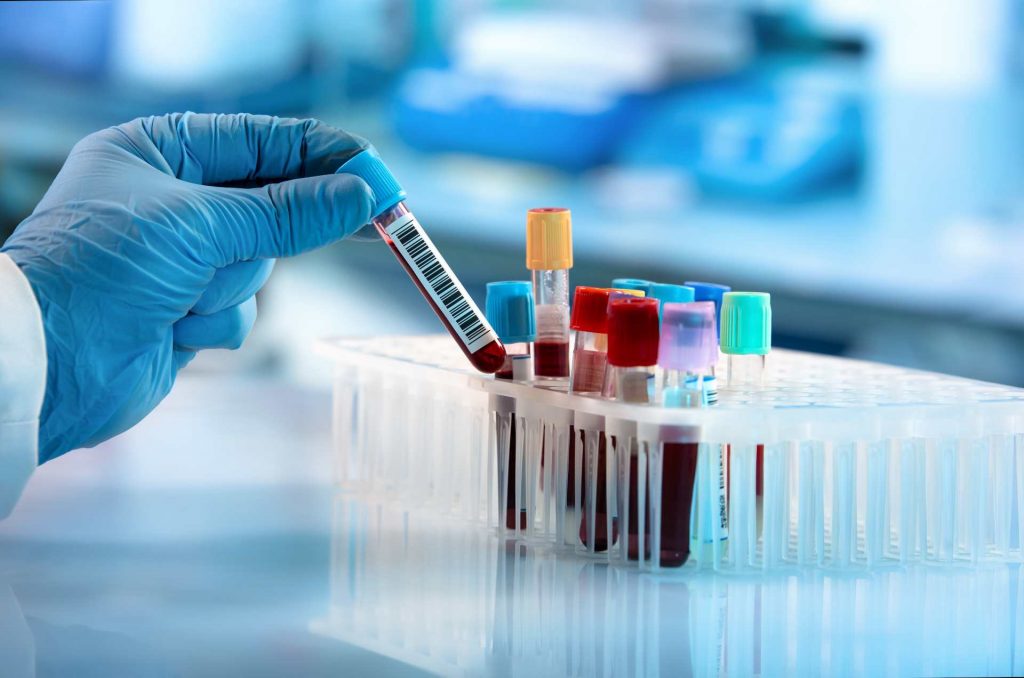tipos de laboratório: laboratório de análises clínicas